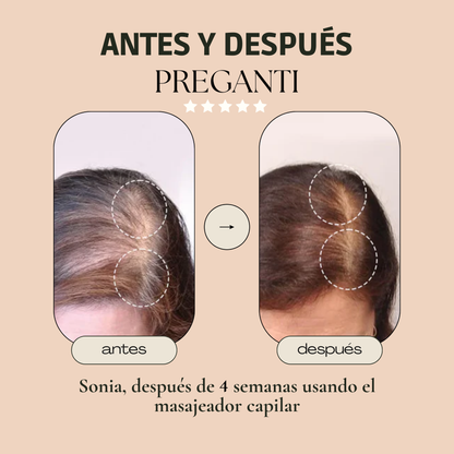 FORTALECE Y DENSIFICA TU CABELLO: ELIMINA LA CAÍDA CON TERAPIA LUZ ROJA - PREGANTI