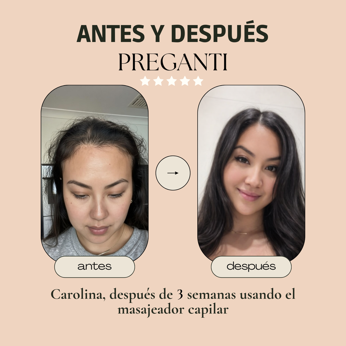 FORTALECE Y DENSIFICA TU CABELLO: ELIMINA LA CAÍDA CON TERAPIA LUZ ROJA - PREGANTI